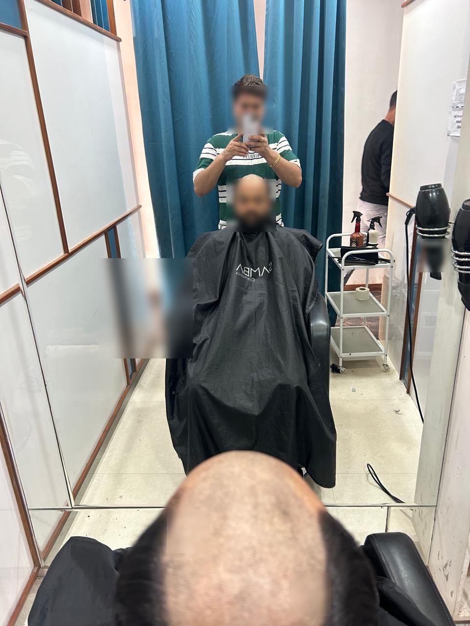 Hair Bonding for Men